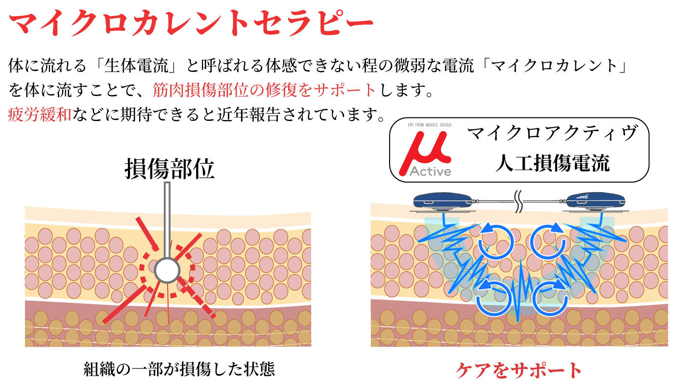 クラウドファンディングプロジェクト：手のひらサイズでお届け　筋肉疲労の早期回復をサポートする微弱電流マイクロカレント「μActive」