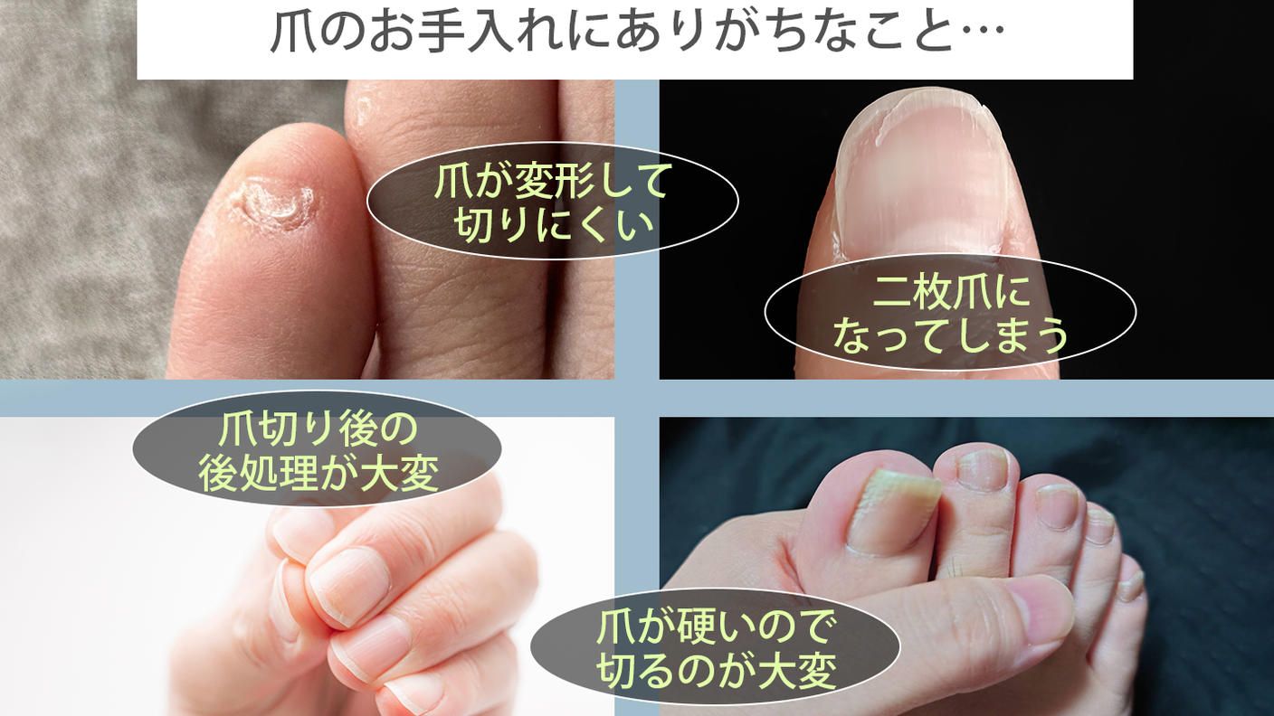クラウドファンディングプロジェクト：硬い爪もスパッと切れる！爪が飛び散らない・やすり掛けもいらない快適な究極の爪切り