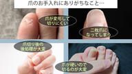 クラウドファンディングプロジェクト：硬い爪もスパッと切れる！爪が飛び散らない・やすり掛けもいらない快適な究極の爪切り